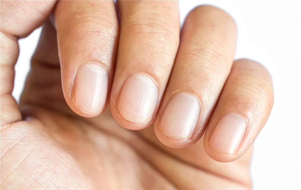 nail fungal treatment