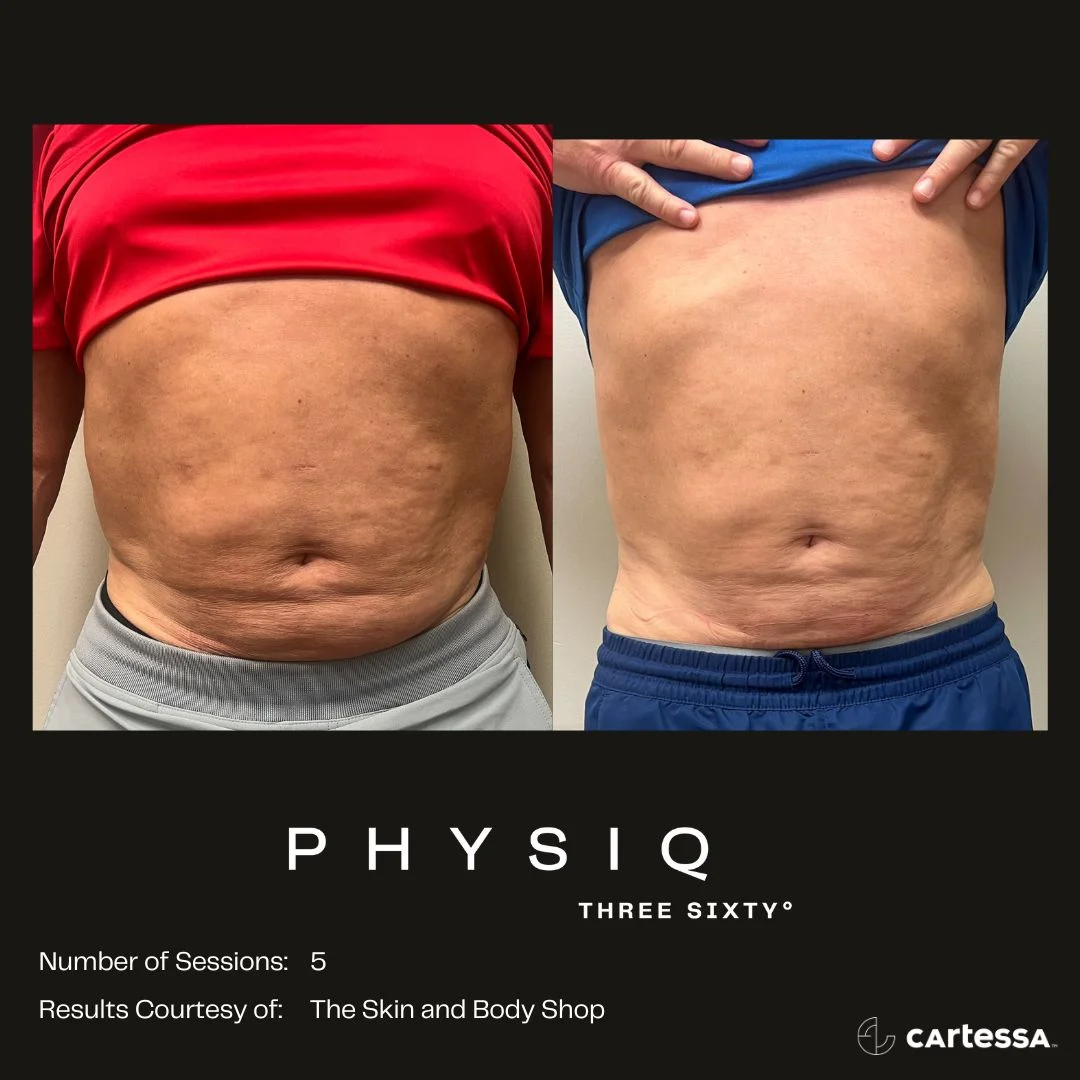 Physiq