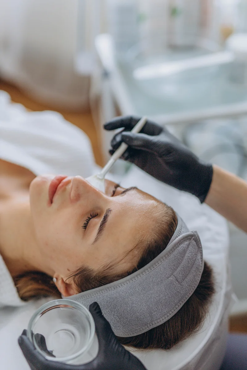 chemical peels