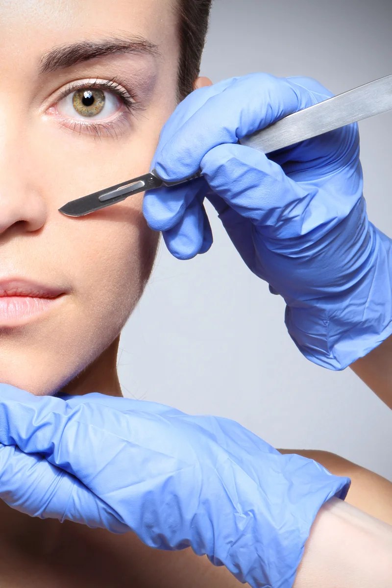 dermaplaining